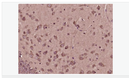 605856f125304.png image.png